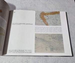 Studio morfologico dei rapporti funzionali fra emocoagulazione e vasi sanguigni